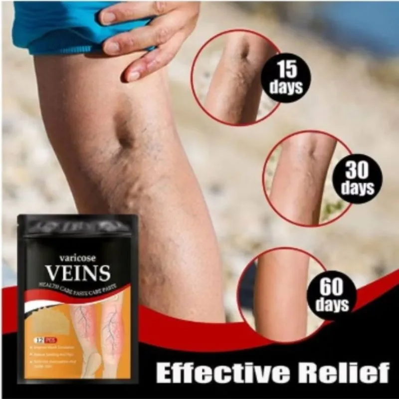 Varicose Veins Relief & Leg Swelling Health Care Patches (12 PCS) (4)